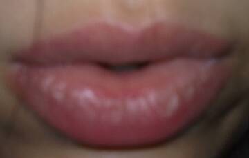 my lips